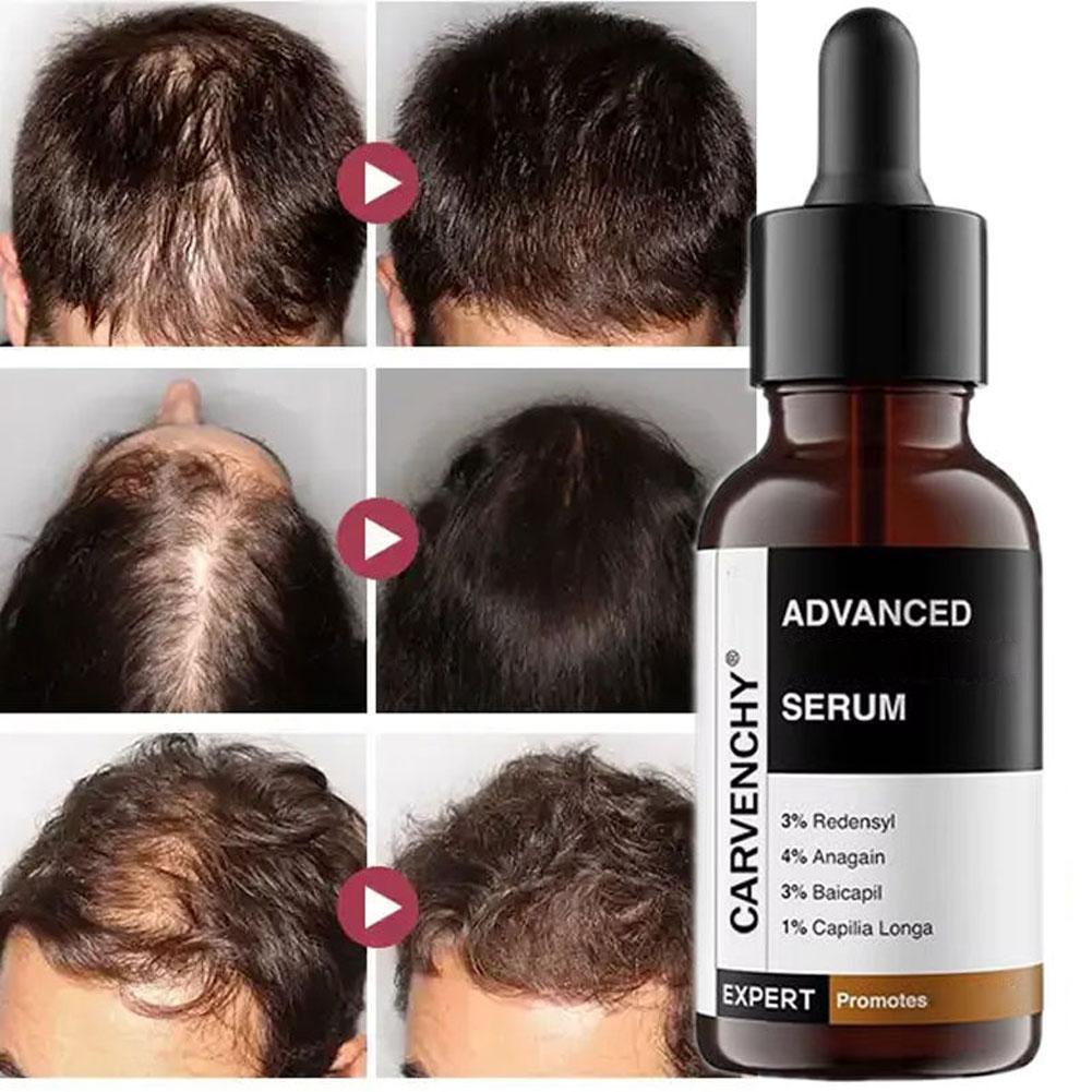 Rosemary Essential Oil For Hai - Hair Care For Men บทวิจารณ์และราคา