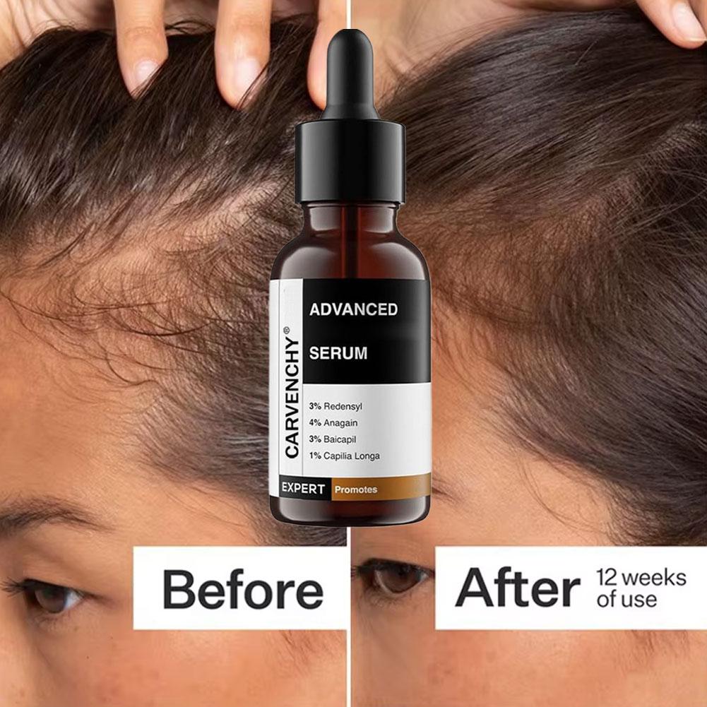 Rosemary Essential Oil For Hai - Hair Care For Men บทวิจารณ์และราคา