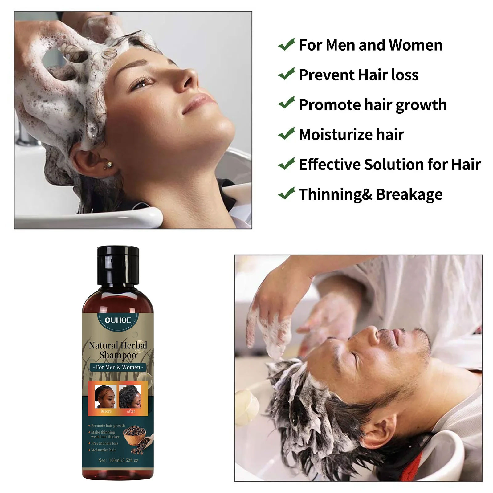 OUHOE Hair Growth Shampoo Anti - Hair Care Dandruff บทวิจารณ์และราคา