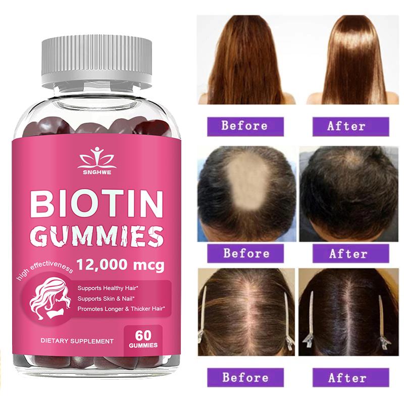 Collagen Gummies Biotin Gummie - Hair Care Gummies บทวิจารณ์และราคา