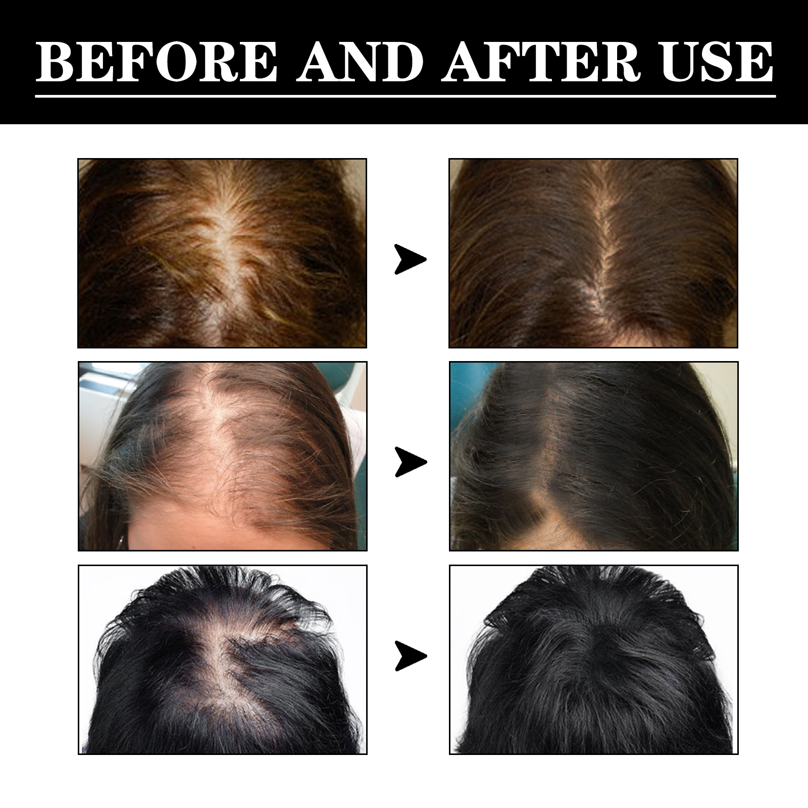 Hair care essence has good per - Hair Care Good Hair บทวิจารณ์และราคา