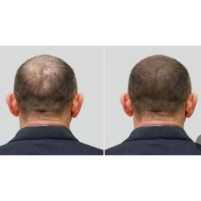 Good Seal Ozone Cap Ozone Hat  - Hair Care Good Hair บทวิจารณ์และราคา