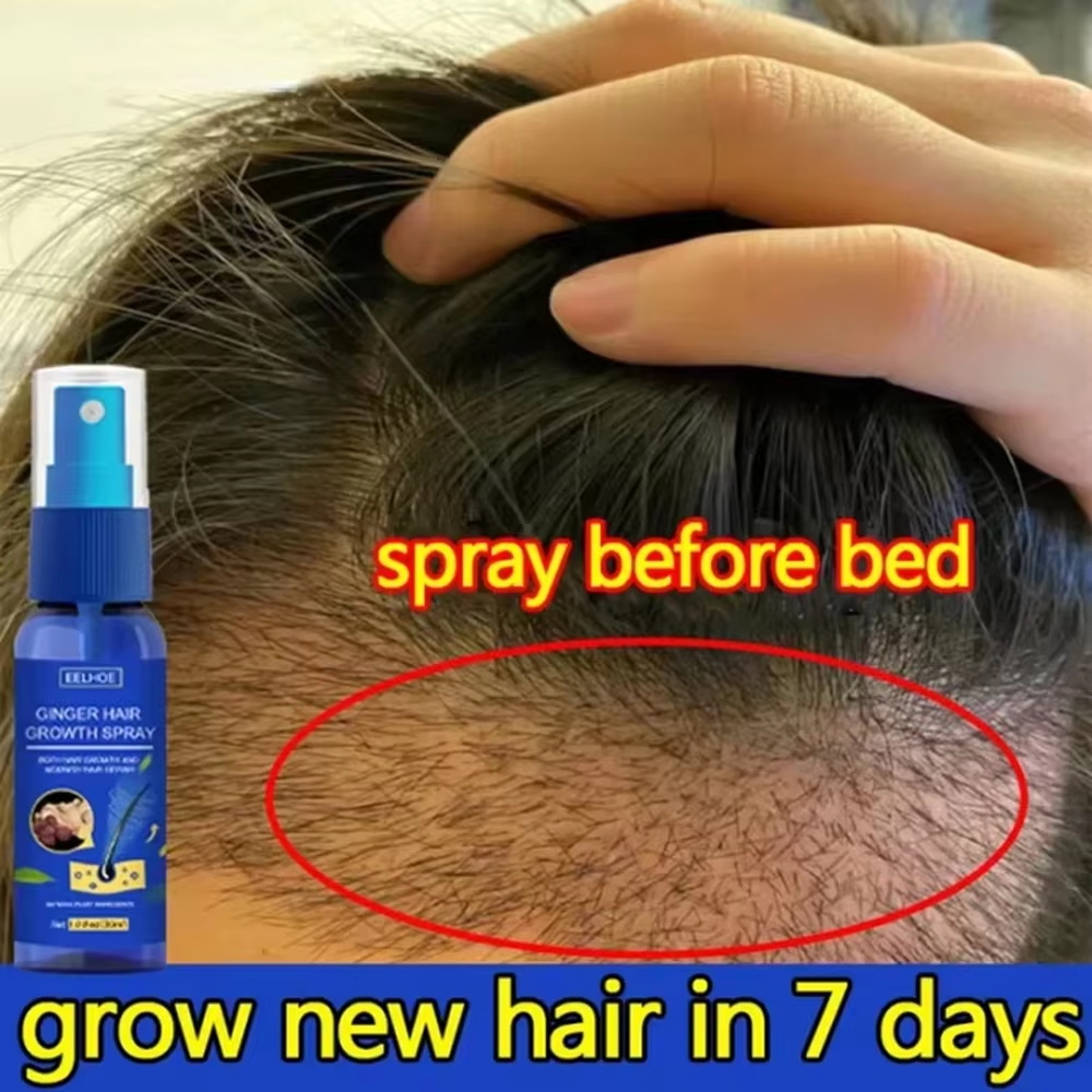 Fast Ginger Hair Growth Spray  - Hair Care For Men บทวิจารณ์และราคา