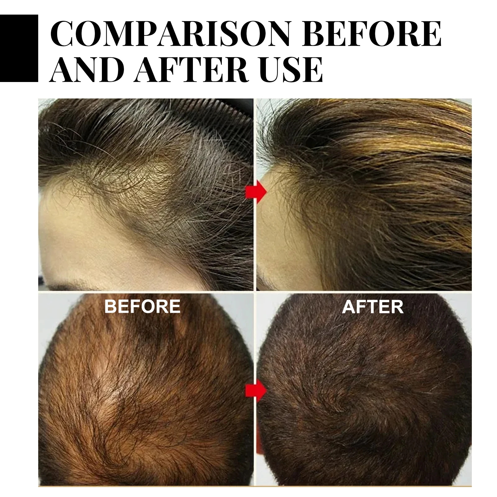 Fast Ginger Hair Growth Spray  - Hair Care For Men บทวิจารณ์และราคา