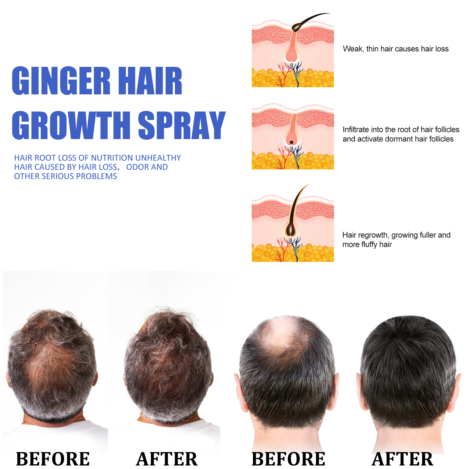 Fast Ginger Hair Growth Spray  - Hair Care For Men บทวิจารณ์และราคา