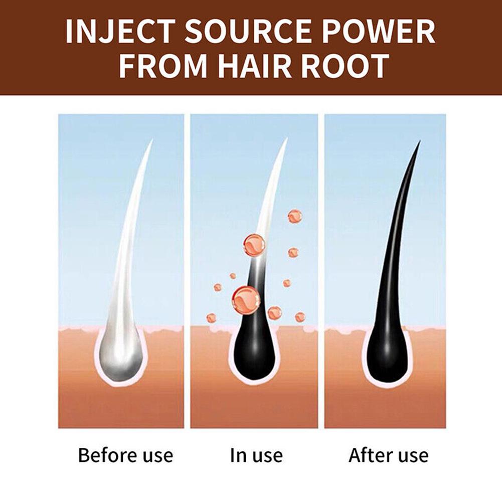 Natural Polygonum Handmade Soa - Hair Care Dandruff บทวิจารณ์และราคา
